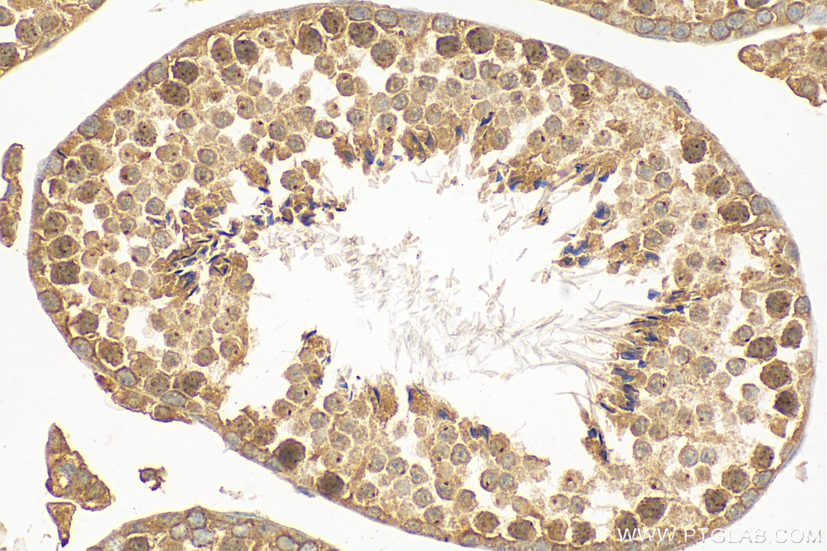 IHC staining of mouse testis using 15280-1-AP