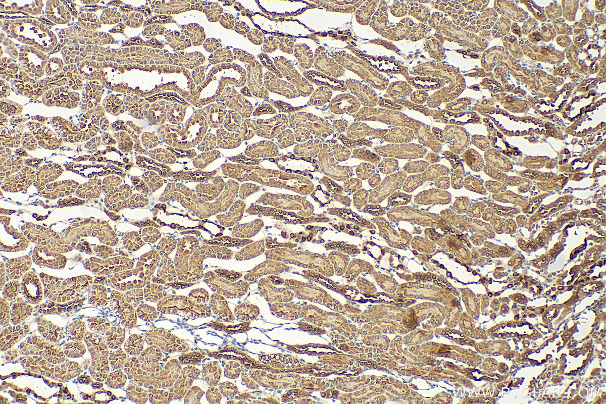 IHC staining of rat kidney using 15280-1-AP