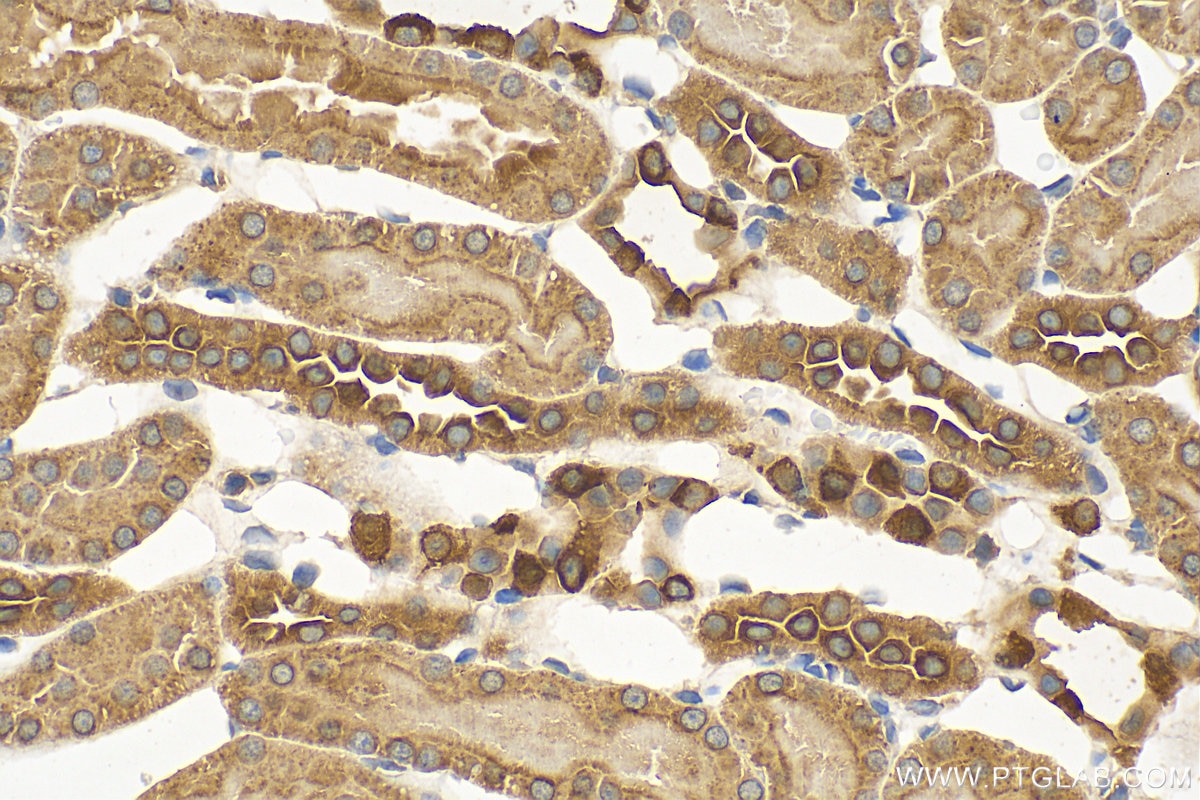 Immunohistochemistry (IHC) staining of rat kidney tissue using ATP6V1E1 Polyclonal antibody (15280-1-AP)
