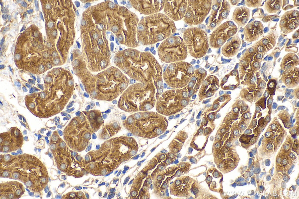Immunohistochemistry (IHC) staining of mouse kidney tissue using ATP6V1E1 Polyclonal antibody (15280-1-AP)