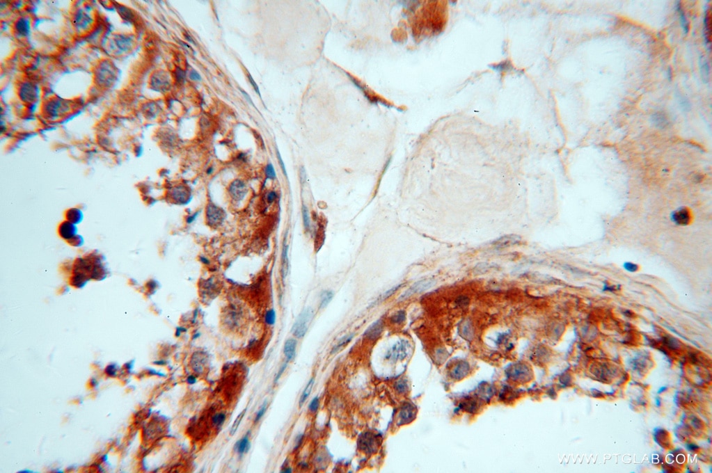 IHC staining of human testis using 15280-1-AP