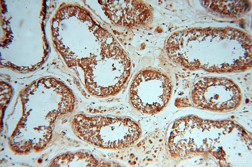 Immunohistochemistry (IHC) staining of human testis tissue using ATP6V1E1 Polyclonal antibody (15280-1-AP)