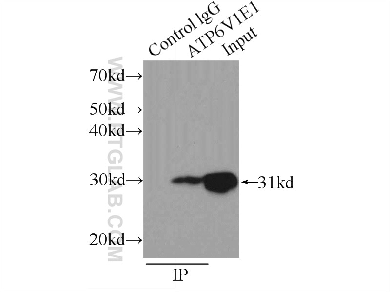Immunoprecipitation (IP) experiment of mouse brain tissue using ATP6V1E1 Polyclonal antibody (15280-1-AP)