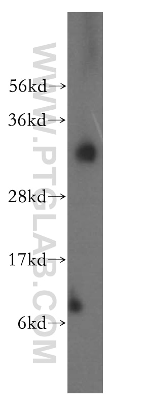 Western Blot (WB) analysis of human liver tissue using ATP6V1E1 Polyclonal antibody (15280-1-AP)