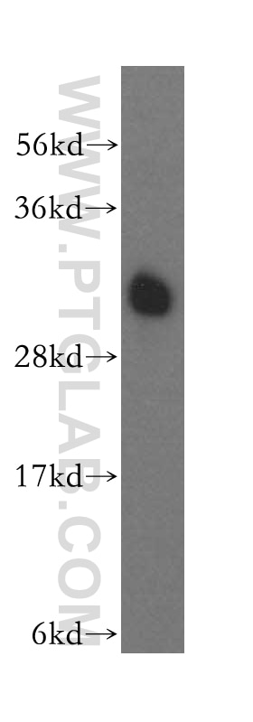 Western Blot (WB) analysis of human brain tissue using ATP6V1E1 Polyclonal antibody (15280-1-AP)