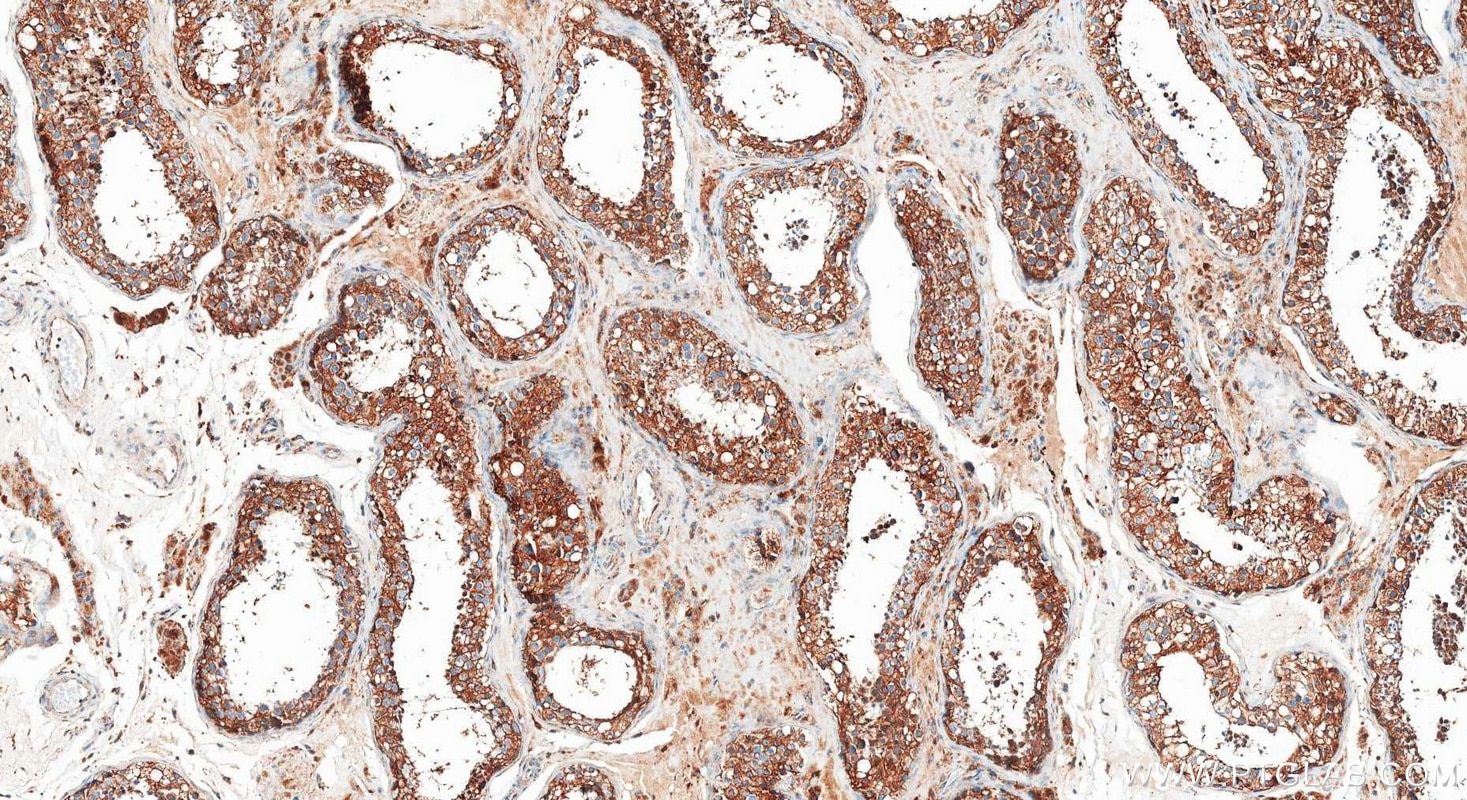 IHC staining of human testis using 83636-6-RR Immunohistochemistry (IHC) staining of human testis tissue using ATP6V1E1 Recombinant monoclonal antibody (83636-6-RR)