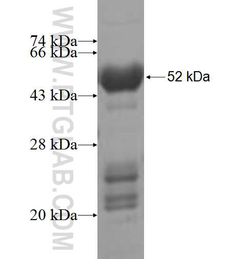 ATP6V1E1 fusion protein Ag7399 SDS-PAGE