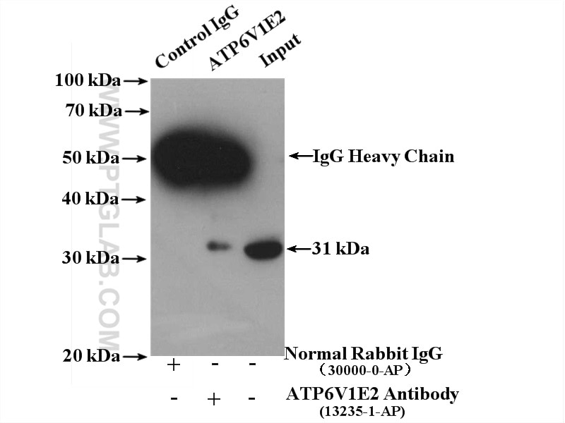 Immunoprecipitation (IP) experiment of mouse brain tissue using ATP6V1E2 Polyclonal antibody (13235-1-AP)