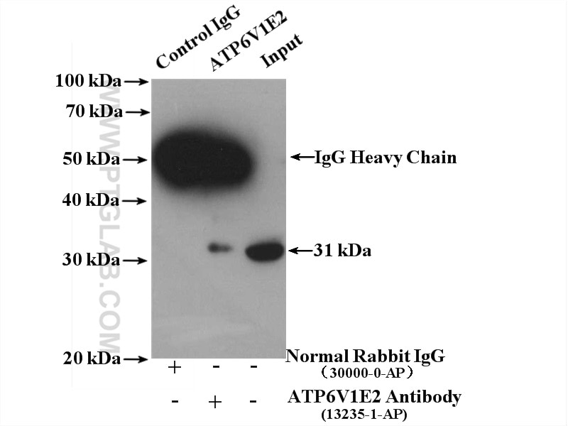 IP experiment of mouse brain using 13235-1-AP