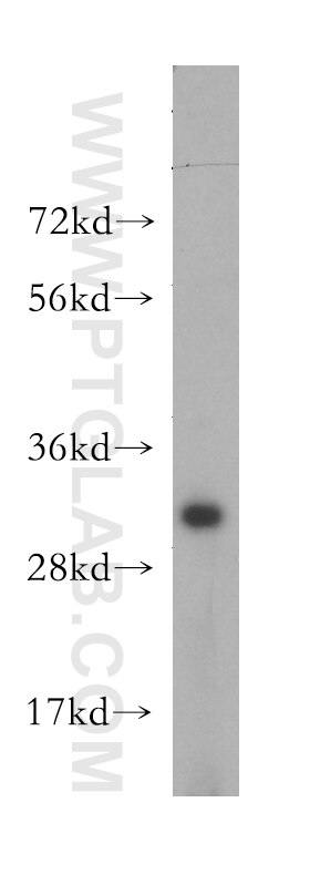 Western Blot (WB) analysis of mouse brain tissue using ATP6V1E2 Polyclonal antibody (13235-1-AP)