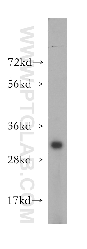 WB analysis of mouse brain using 13235-1-AP