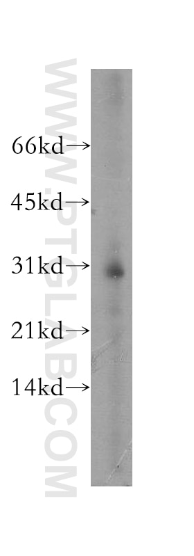Western Blot (WB) analysis of MCF-7 cells using ATP6V1E2 Polyclonal antibody (13235-1-AP)