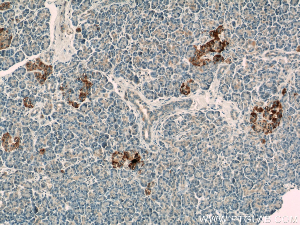 Immunohistochemistry (IHC) staining of human pancreas tissue using ATP6V1F Polyclonal antibody (17725-1-AP)