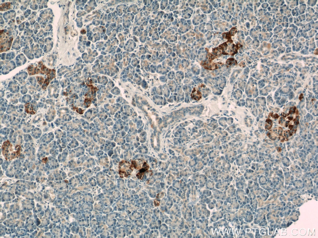 IHC staining of human pancreas using 17725-1-AP