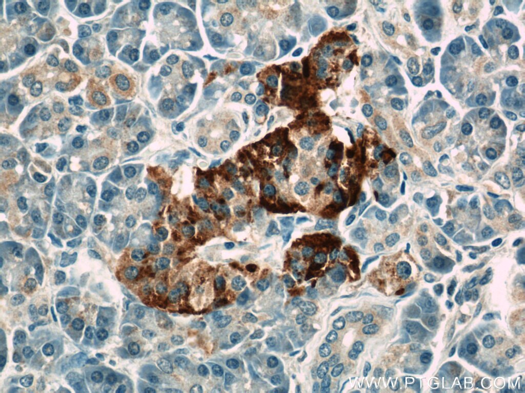 Immunohistochemistry (IHC) staining of human pancreas tissue using ATP6V1F Polyclonal antibody (17725-1-AP)