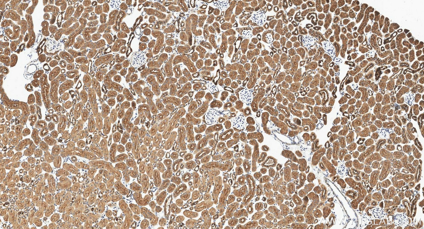 Immunohistochemistry (IHC) staining of mouse kidney tissue using ATP6V1F Polyclonal antibody (17725-1-AP)