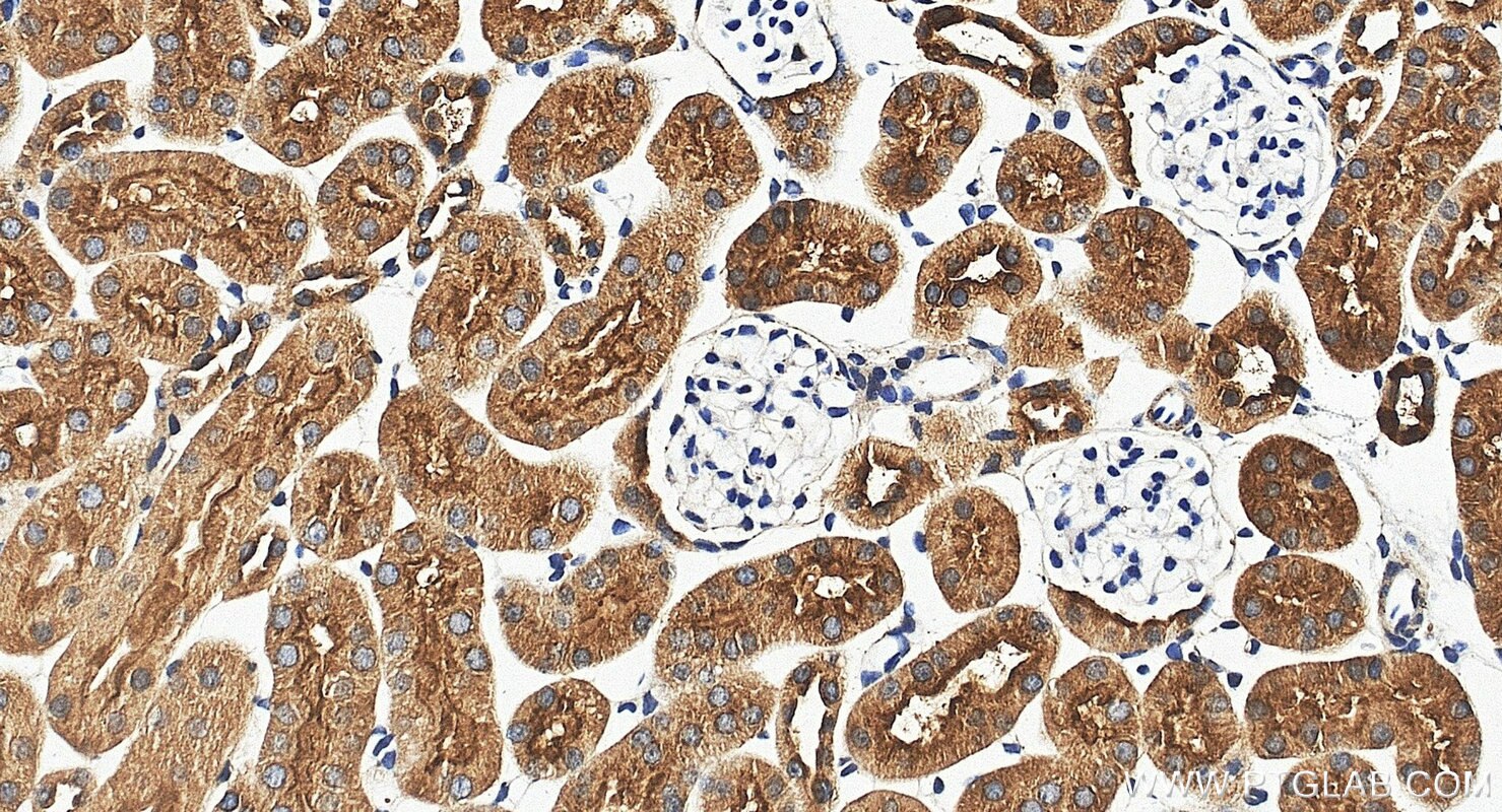 Immunohistochemistry (IHC) staining of mouse kidney tissue using ATP6V1F Polyclonal antibody (17725-1-AP)