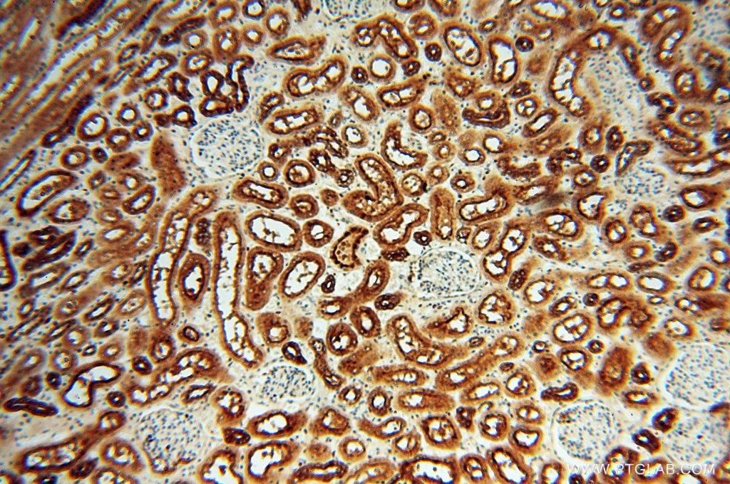 Immunohistochemistry (IHC) staining of human kidney tissue using ATP6V1F Polyclonal antibody (17725-1-AP)
