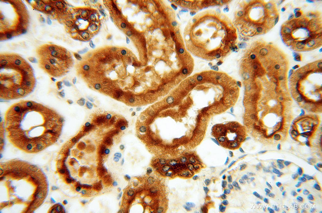 Immunohistochemistry (IHC) staining of human kidney tissue using ATP6V1F Polyclonal antibody (17725-1-AP)