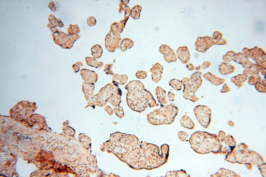 IHC staining of human placenta using 17725-1-AP