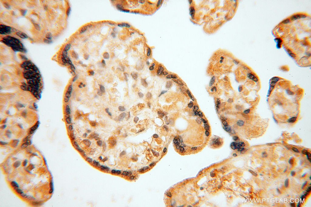 Immunohistochemistry (IHC) staining of human placenta tissue using ATP6V1F Polyclonal antibody (17725-1-AP)