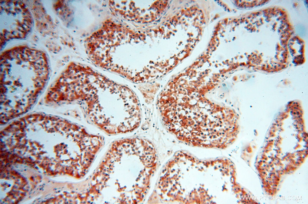 Immunohistochemistry (IHC) staining of human testis tissue using ATP6V1F Polyclonal antibody (17725-1-AP)