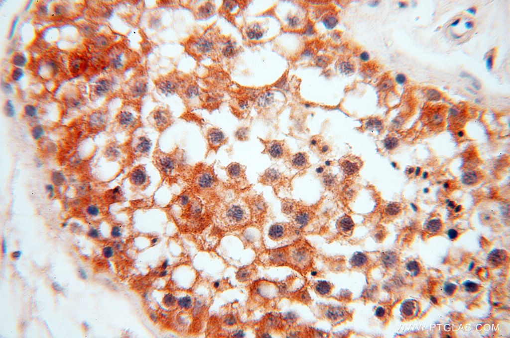 Immunohistochemistry (IHC) staining of human testis tissue using ATP6V1F Polyclonal antibody (17725-1-AP)