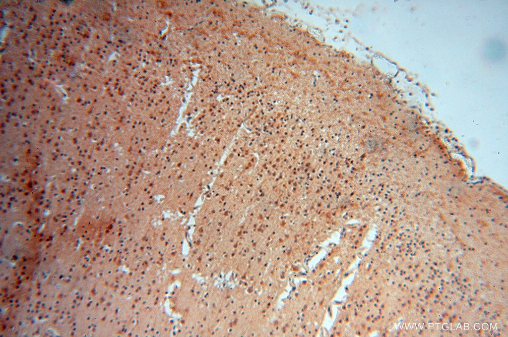 Immunohistochemistry (IHC) staining of human brain tissue using ATP6V1F Polyclonal antibody (17725-1-AP)