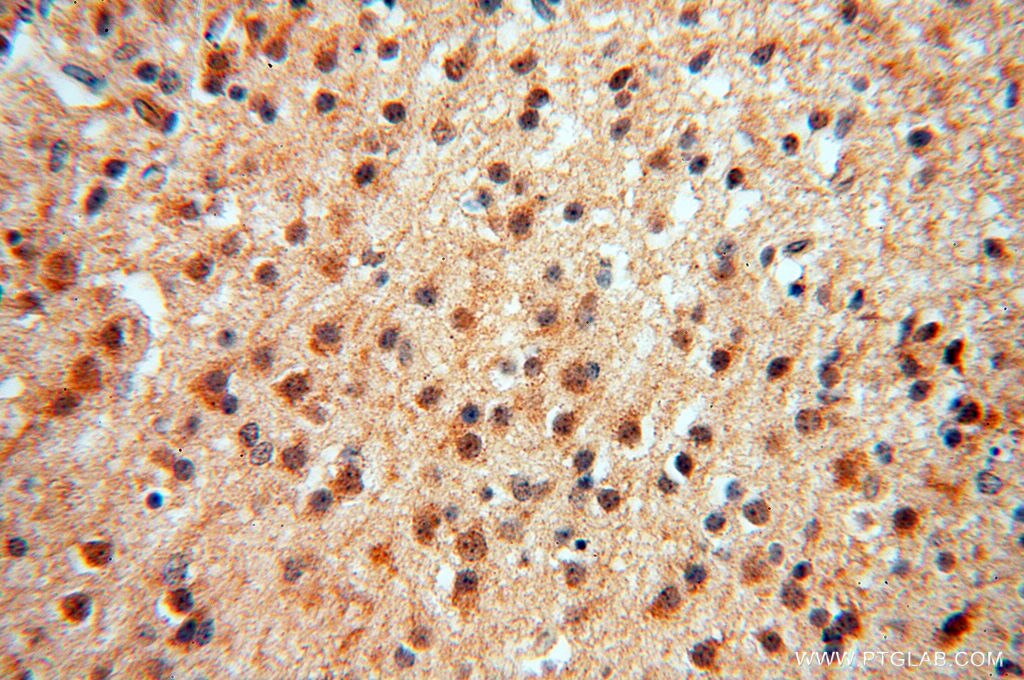 Immunohistochemistry (IHC) staining of human brain tissue using ATP6V1F Polyclonal antibody (17725-1-AP)