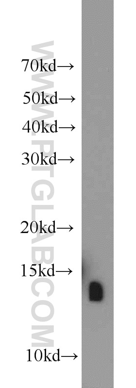 Western Blot (WB) analysis of mouse skeletal muscle tissue using ATP6V1F Polyclonal antibody (17725-1-AP)