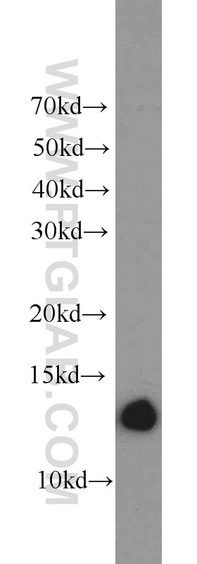 WB analysis of MCF-7 using 17725-1-AP