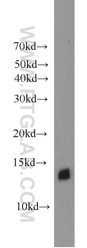 WB analysis of HeLa using 17725-1-AP