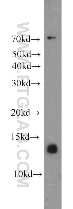 Western Blot (WB) analysis of Jurkat cells using ATP6V1F Polyclonal antibody (17725-1-AP)