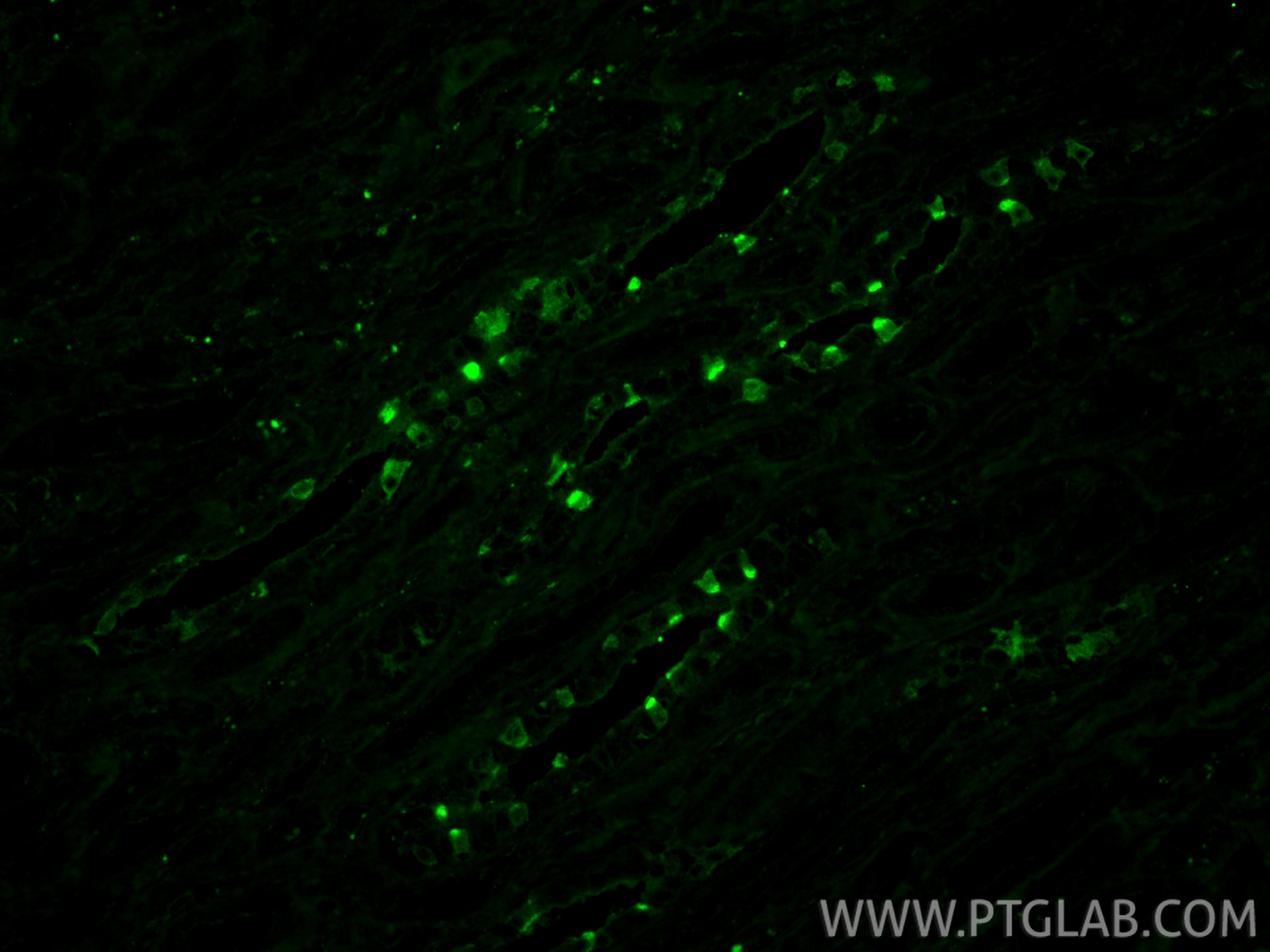 IF Staining of human kidney using 87157-1-RR Immunofluorescence (IF) / fluorescent staining of human kidney tissue using ATP6V1F Recombinant monoclonal antibody (87157-1-RR)