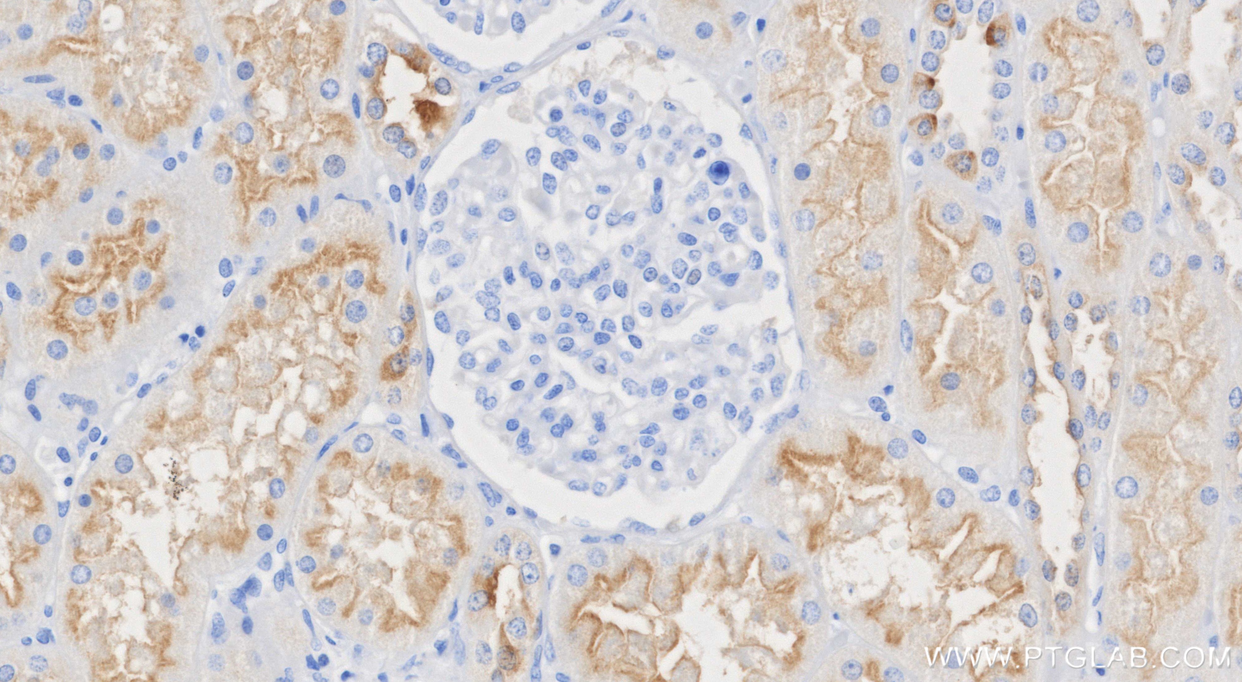 Immunohistochemistry (IHC) staining of human kidney tissue using ATP6V1F Recombinant monoclonal antibody (87157-1-RR)