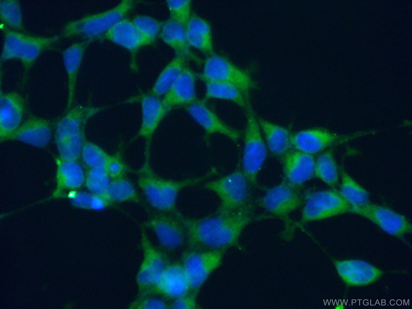 Immunofluorescence (IF) / fluorescent staining of HEK-293 cells using ATP6V1G1 Polyclonal antibody (16143-1-AP)
