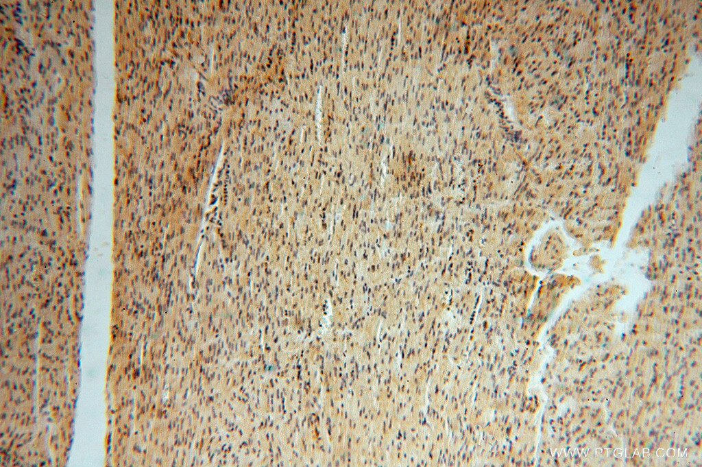 Immunohistochemistry (IHC) staining of human heart tissue using ATP6V1G1 Polyclonal antibody (16143-1-AP)