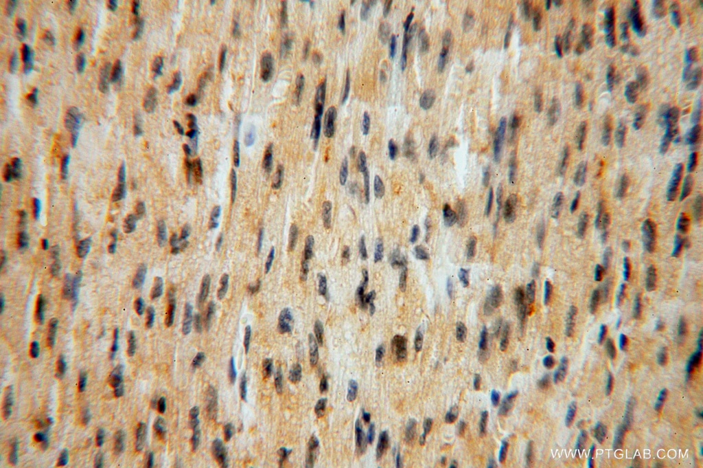 Immunohistochemistry (IHC) staining of human heart tissue using ATP6V1G1 Polyclonal antibody (16143-1-AP)