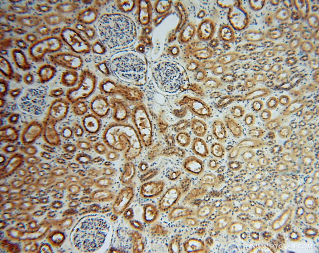 Immunohistochemistry (IHC) staining of human kidney tissue using ATP6V1G1 Polyclonal antibody (16143-1-AP)