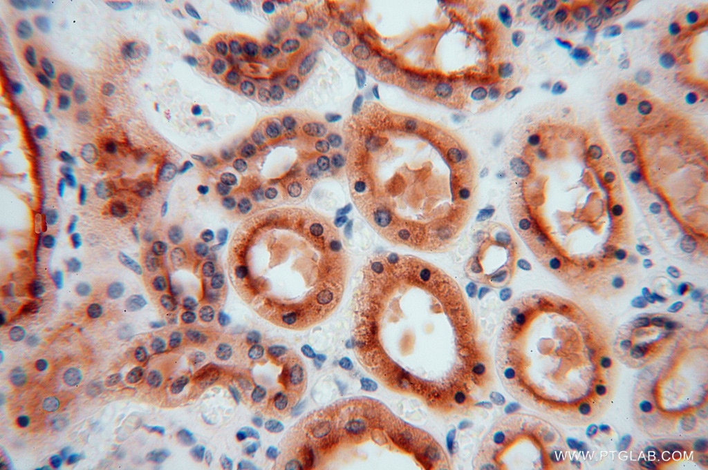 Immunohistochemistry (IHC) staining of human kidney tissue using ATP6V1G1 Polyclonal antibody (16143-1-AP)