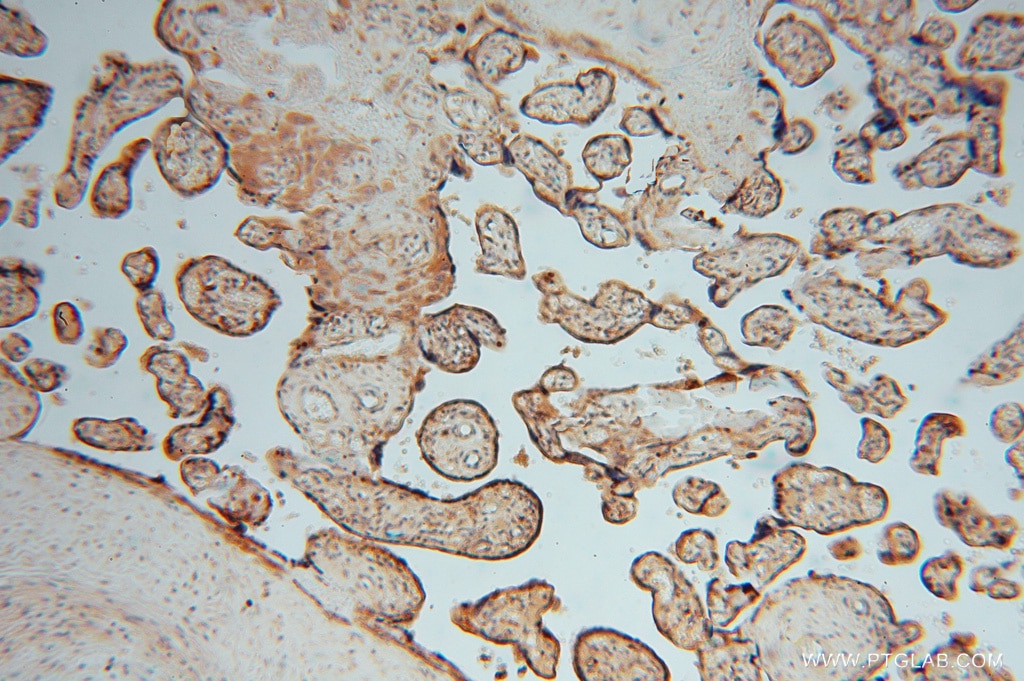 IHC staining of human placenta using 16143-1-AP