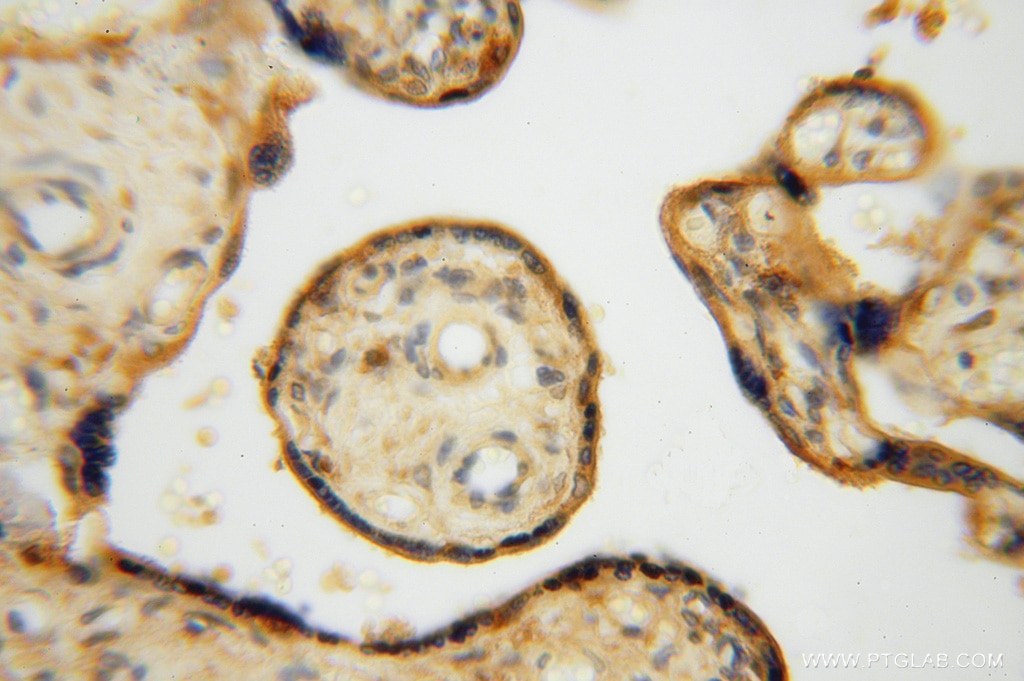 IHC staining of human placenta using 16143-1-AP