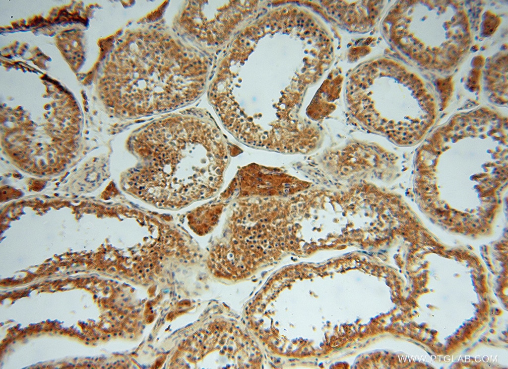 Immunohistochemistry (IHC) staining of human testis tissue using ATP6V1G1 Polyclonal antibody (16143-1-AP)