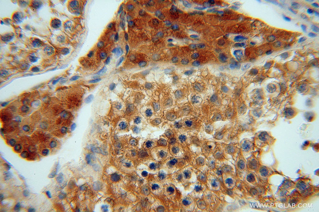 Immunohistochemistry (IHC) staining of human testis tissue using ATP6V1G1 Polyclonal antibody (16143-1-AP)