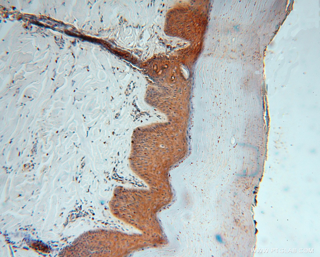 Immunohistochemistry (IHC) staining of human skin tissue using ATP6V1G1 Polyclonal antibody (16143-1-AP)