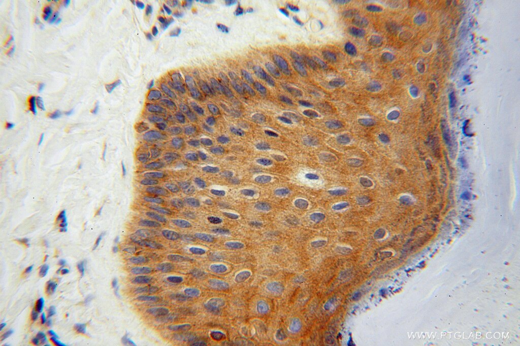 IHC staining of human skin using 16143-1-AP