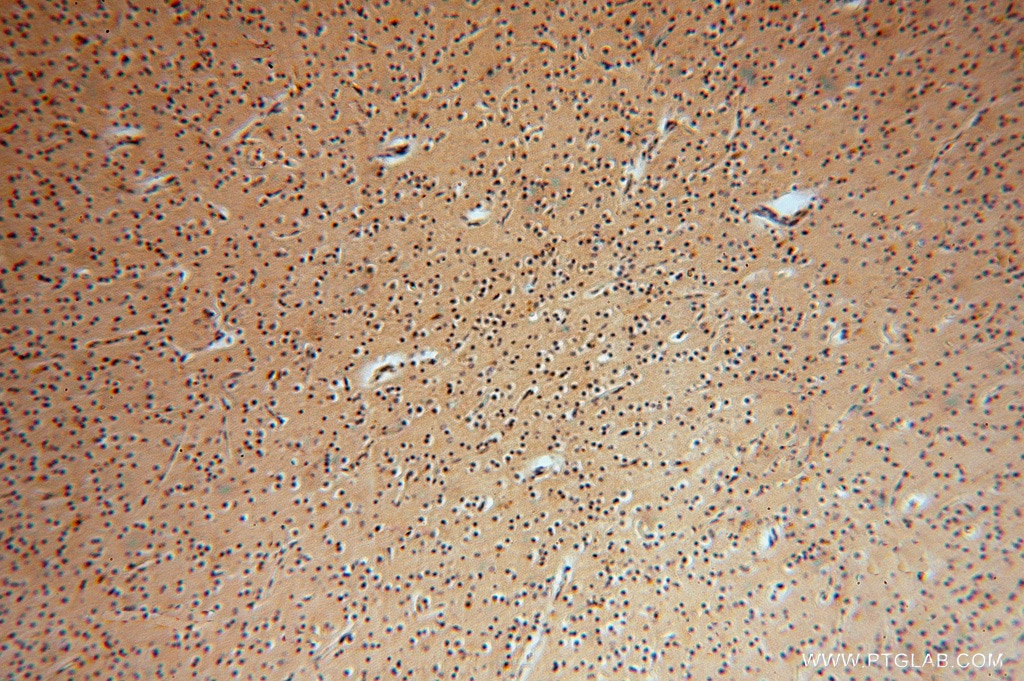 Immunohistochemistry (IHC) staining of human brain tissue using ATP6V1G1 Polyclonal antibody (16143-1-AP)