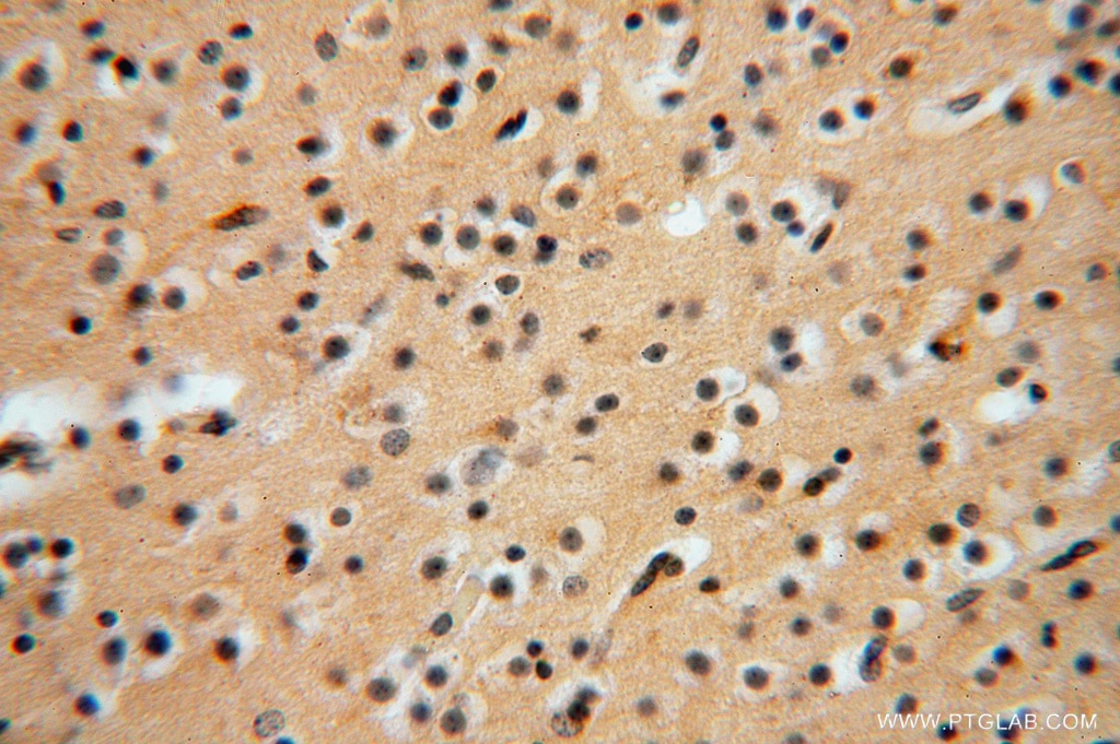 Immunohistochemistry (IHC) staining of human brain tissue using ATP6V1G1 Polyclonal antibody (16143-1-AP)