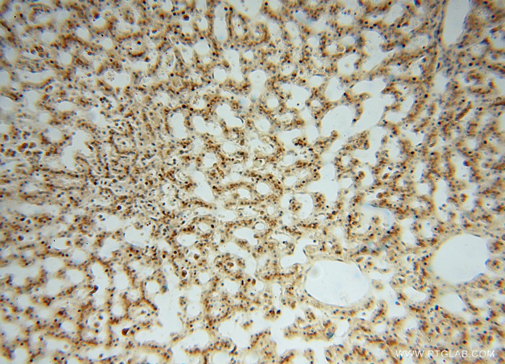 Immunohistochemistry (IHC) staining of human liver tissue using ATP6V1G1 Polyclonal antibody (16143-1-AP)