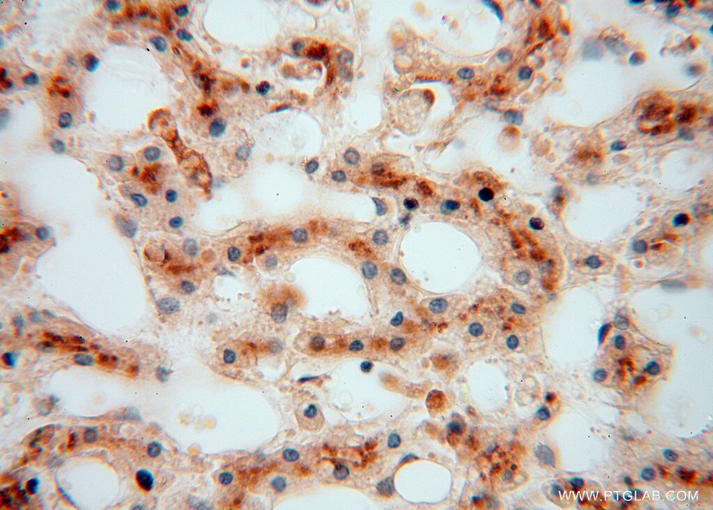 Immunohistochemistry (IHC) staining of human liver tissue using ATP6V1G1 Polyclonal antibody (16143-1-AP)